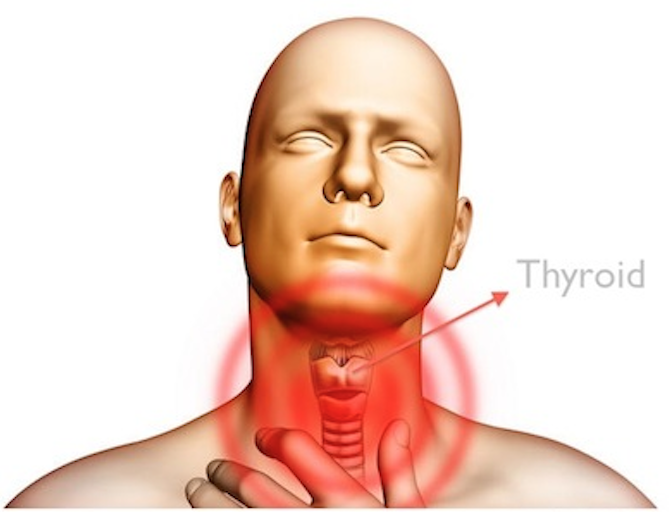 Hypothyroidism and Nutrition – What’s the Connection?